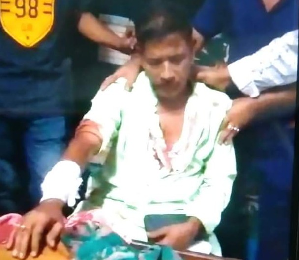 বেনাপোলে প্রতিপক্ষের হামলায় আহত একজন