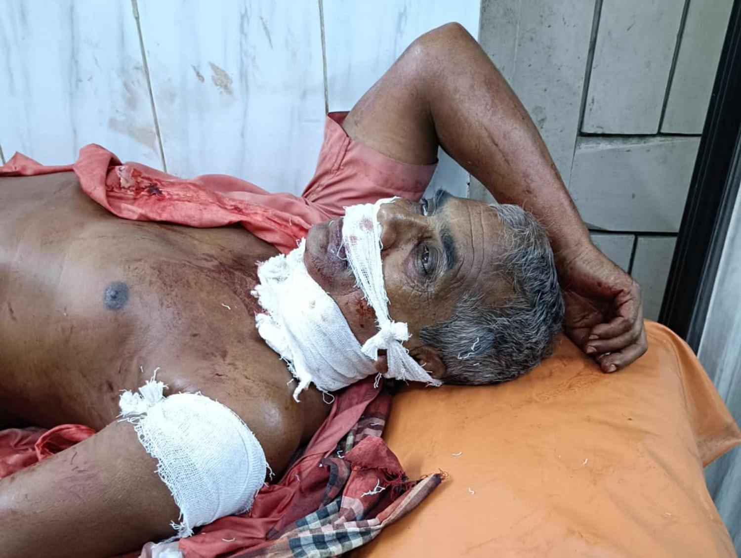 চাটমোহরে গলায় ছুরি চালিয়ে বৃদ্ধ জেলেকে হত্যাচেষ্টা