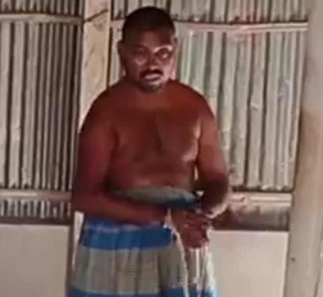 Shahan Ali, chained for 24 years in Durgapur, has not received advanced treatment