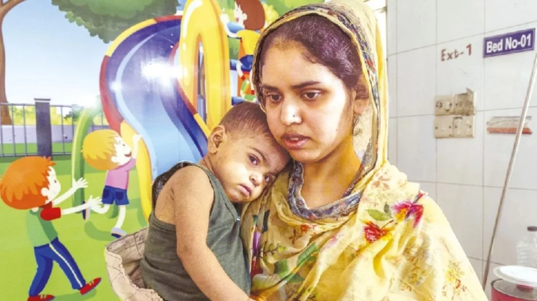 94 children die of measles symptoms in 19 days, nearly 6,000 infected, nationwide concern